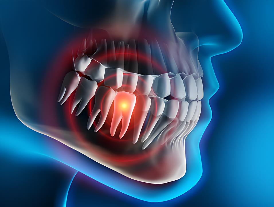 Teeth image - Emergency dentist Chalfont St Peter